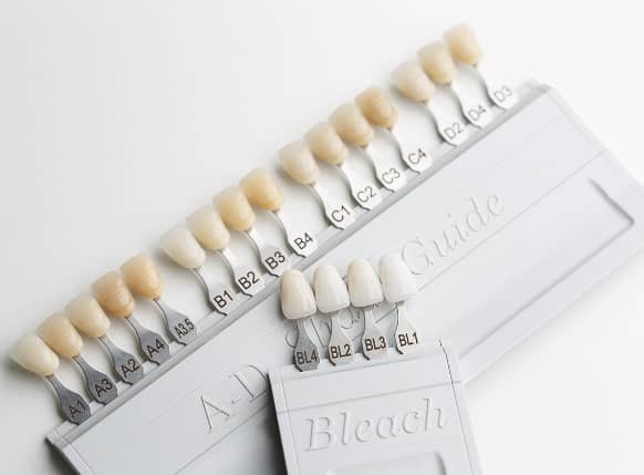 Keramisches Farbmuster für die Farbnahme von Veneers